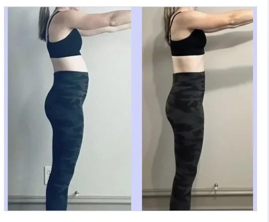 Side-by-side client progress photos showing changes in standing posture and core alignment.