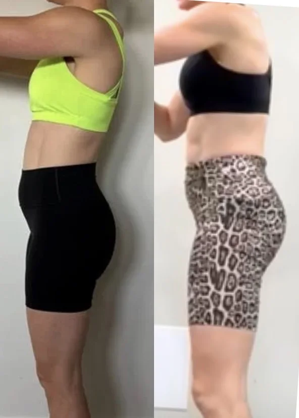 Side-by-side client progress photos showing changes in side posture and alignment.