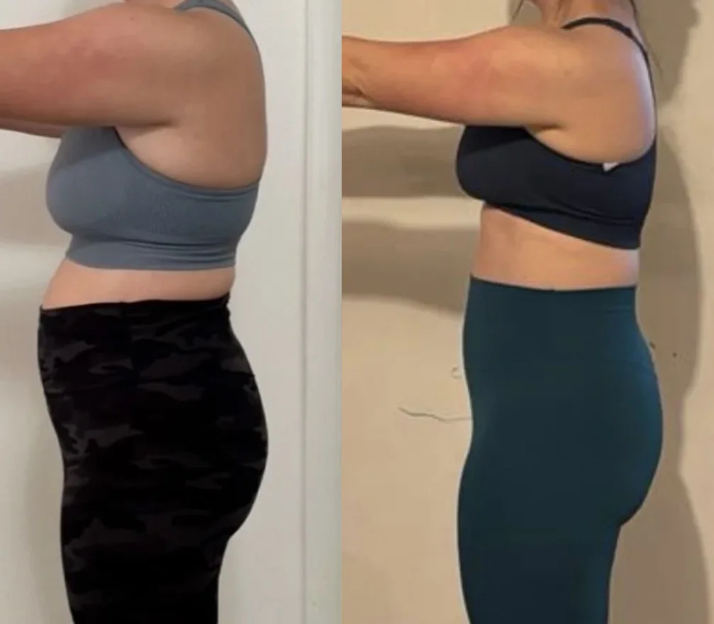 Client progress comparison showing changes in ribcage, pelvis, and standing posture.
