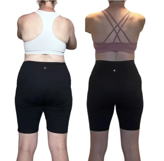 Side-by-side back-view client progress photos showing changes in alignment.