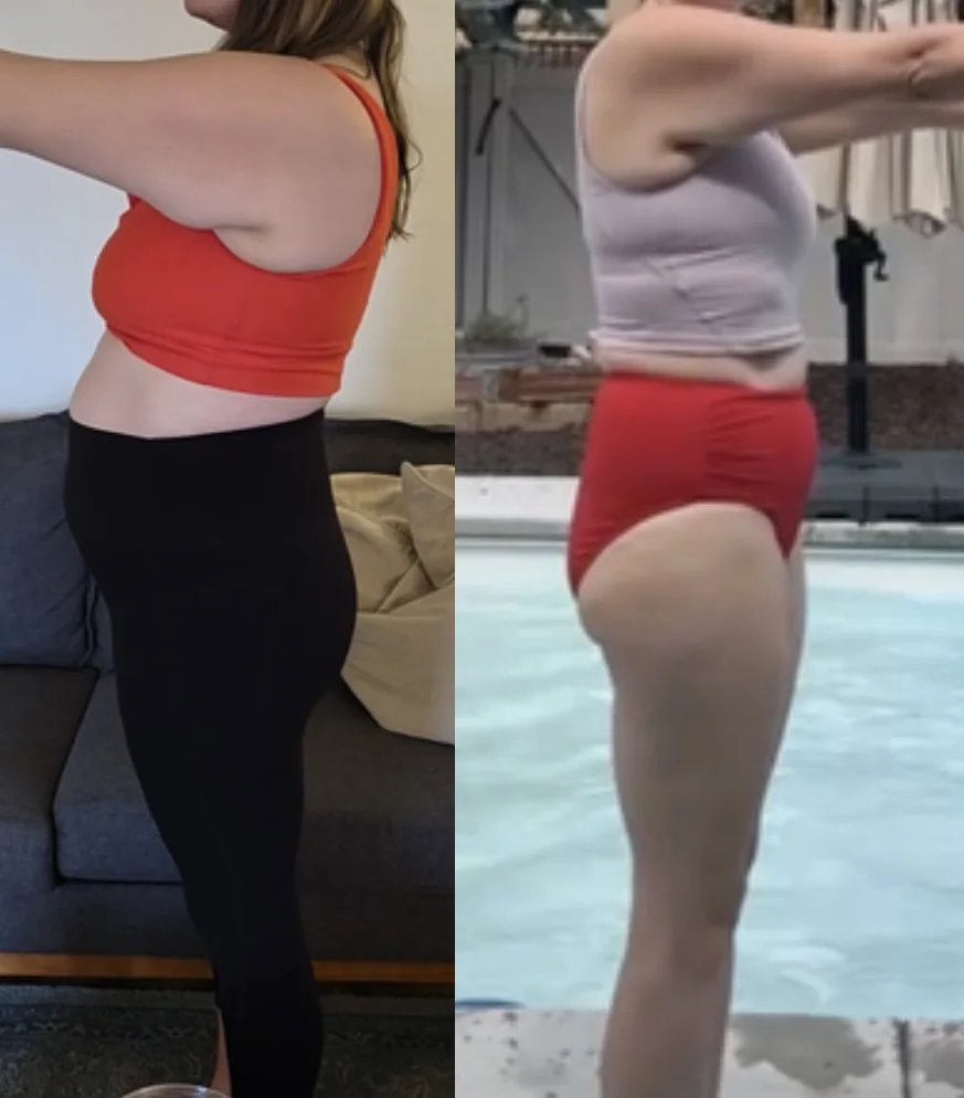 Side-by-side client progress photos showing changes in standing posture.